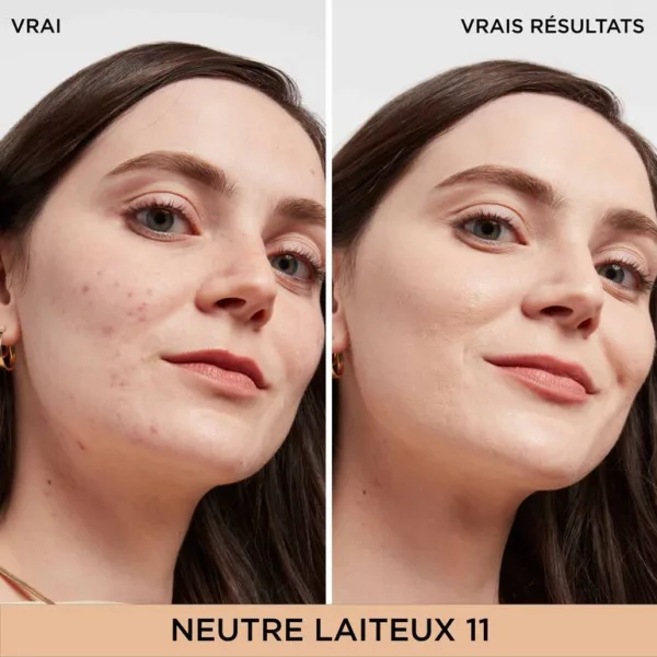 Bye Bye Dark Spots anti-Cernes + Sérum avec 2% de niacinamide Magasin - vente & achat en ligne Casablanca Maroc
